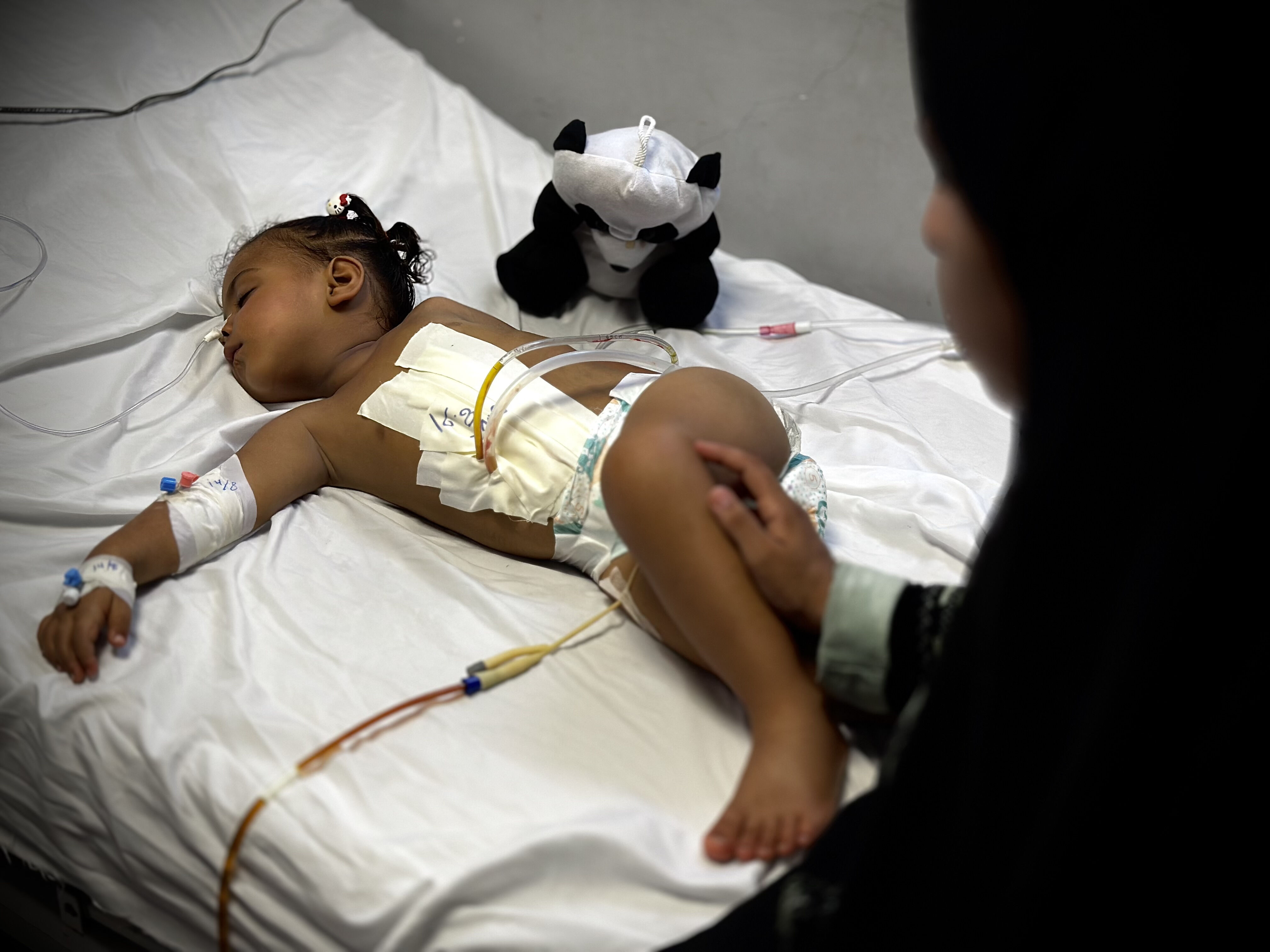 İsrail'in bombaları oyun oynarken iç organlarını deldi! Gazzeli minik Cumana Neccar tedavi edilmeyi bekliyor - 1. Resim