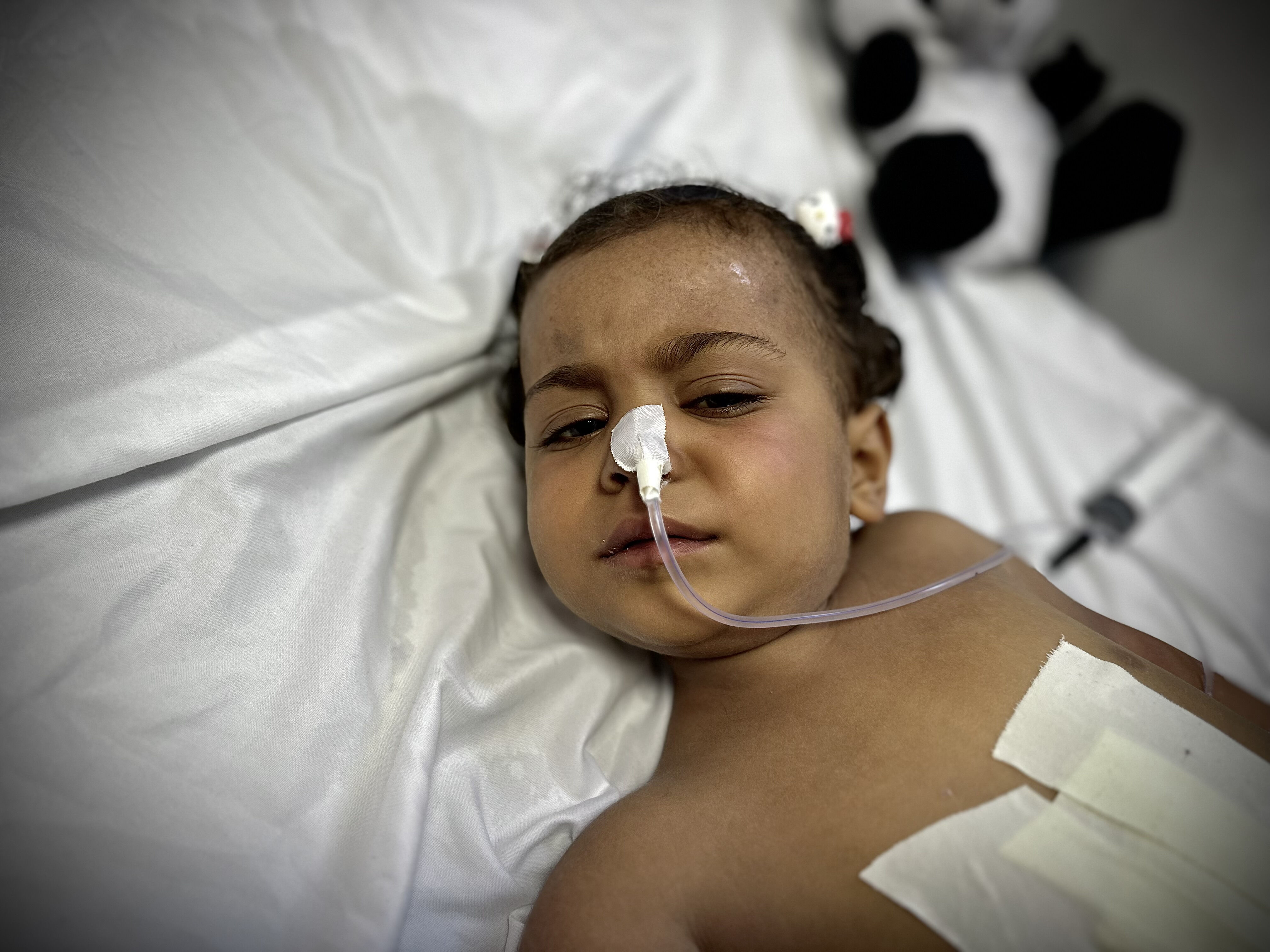 İsrail'in bombaları oyun oynarken iç organlarını deldi! Gazzeli minik Cumana Neccar tedavi edilmeyi bekliyor - 3. Resim