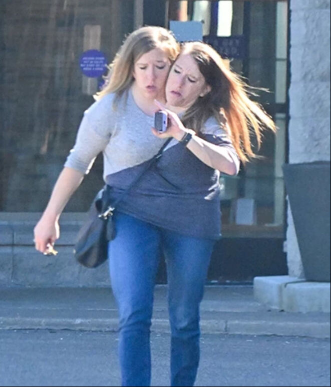 Doktorlar 'imkansız' demişti... Dünyayı şaşırtan ikizlerden sürpriz görüntü - 2. Resim