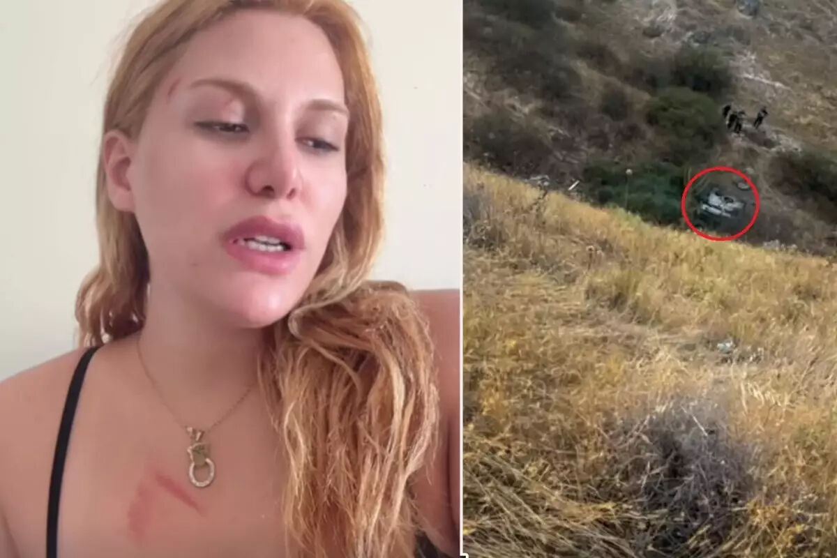 Survivor Almeda Baylan ölümden döndü! O korku dolu anları anlattı: 