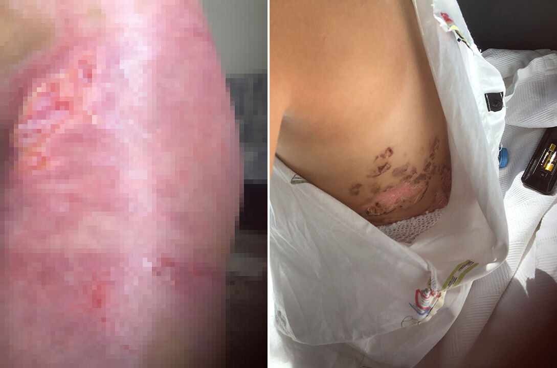 Gelin damadın hevesi k&uuml;&ccedil;&uuml;k kızın felaketi oldu! D&uuml;ğ&uuml;n şovu 8 yaşındaki &ccedil;ocuğu yoğun bakımlık etti - 2. Resim