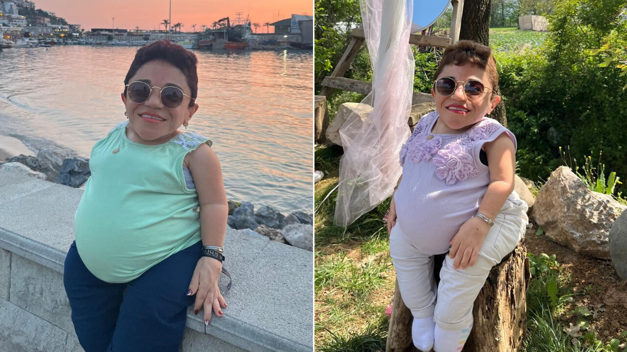 Karın ağrısı sandı, 3 kilogramlık kist çıktı! Akondroplazi hastası kadın sağlığına kavuştu - 1. Resim