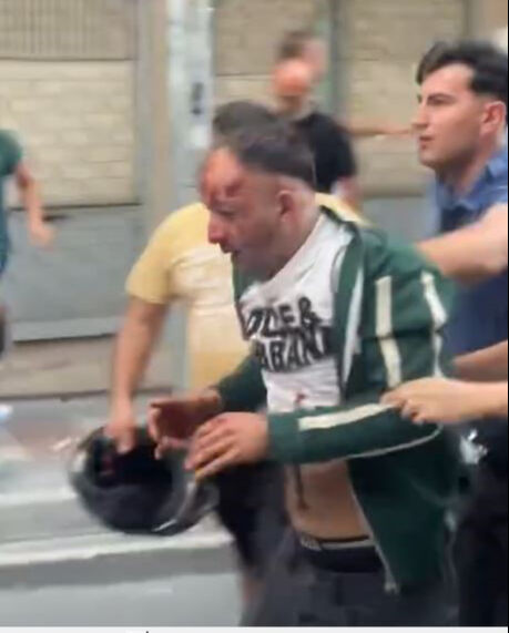 Kadına bıçaklı saldırıya duyarsız kalamadılar! Çığlık duyan koştu, zanlıyı linç ettiler - 4. Resim