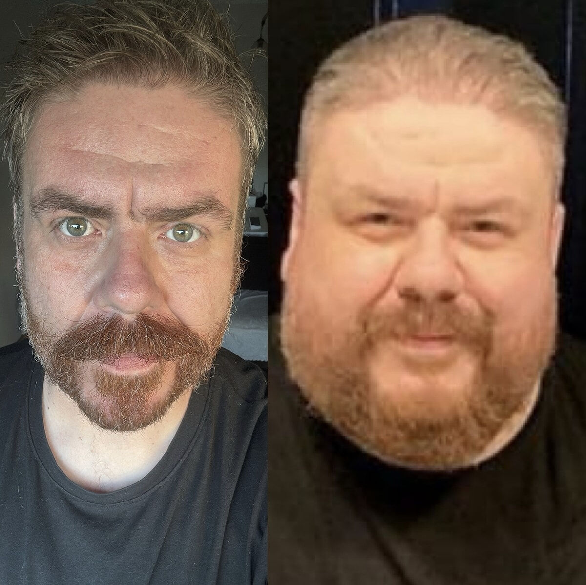 Komedyen Emre Bulut 18 ayda 133 kilo verdi! Son hali herkesi şaşırttı - 3. Resim