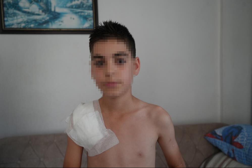 Köpek kolunu parçalamıştı! Küçük çocuğun sağ kolu felç kaldı... Aile adalet arıyor - 3. Resim