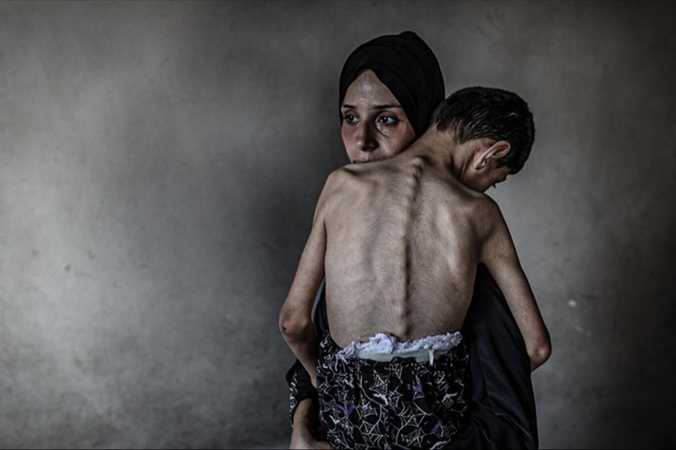 BM Gazze’de resmen kıtlık ilan etti! Her 10 bin kişiden ikisi açlıktan ölüyor - 1. Resim