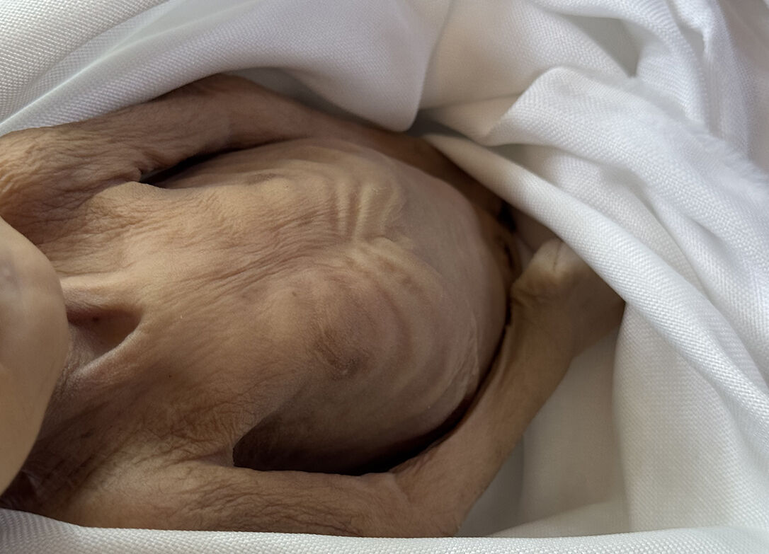 İsrail çadırlara saldırdı, 25 Filistinli hayatını kaybetti! Gazzeli bebekler hayata tutunmaya çalışıyor - 5. Resim