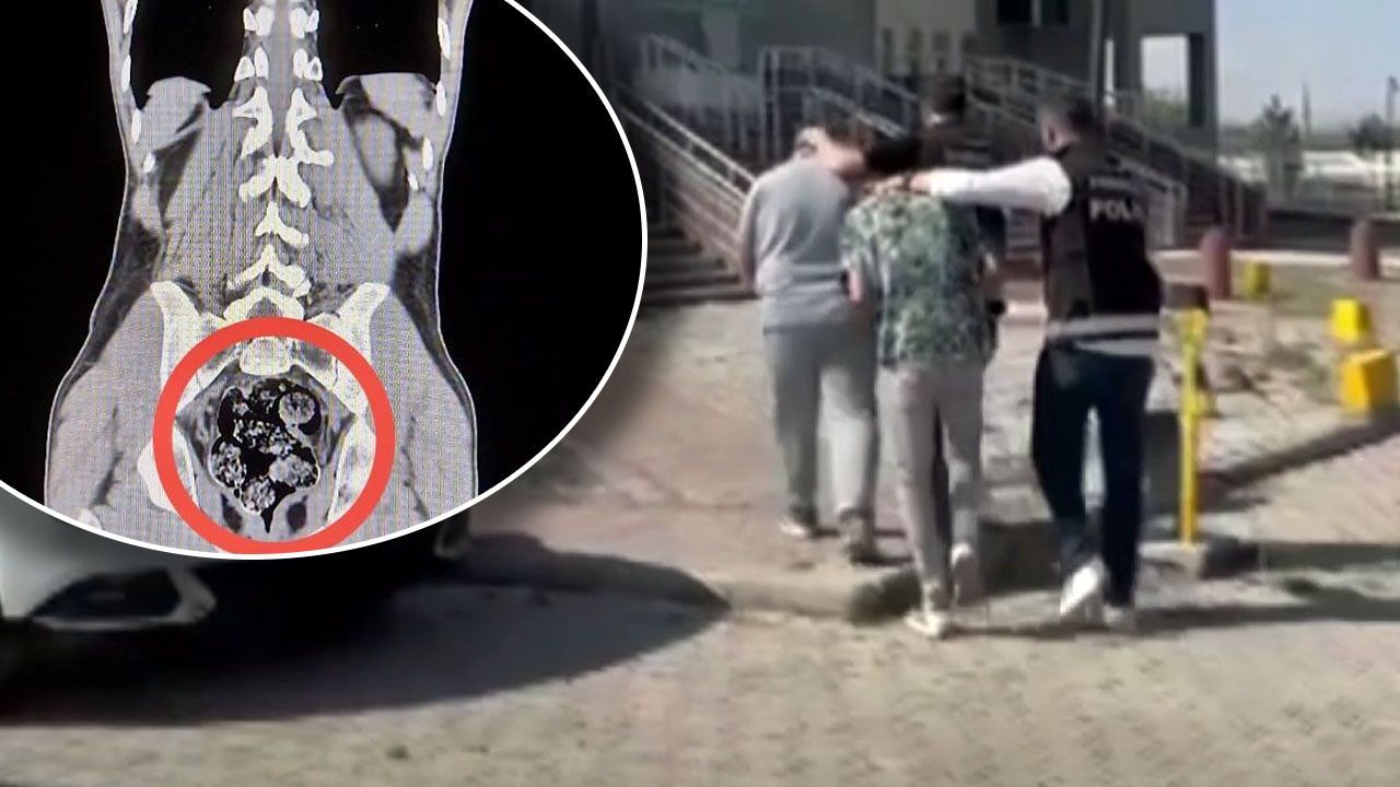 Otobüste yakalandılar, hastanede şoke ettiler! Makatından 7 parça uyuşturucu çıktı Otobüste yakalandılar, hastanede şoke ettiler! Makatından 7 parça uyuşturucu çıktı