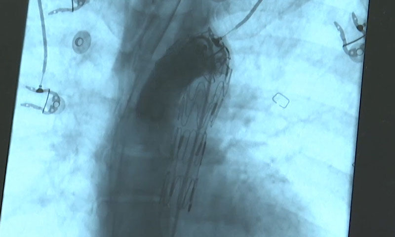 Tavuk yerken az daha ölüyordu! 7 kez ameliyat oldu, 36 kiloya kadar düştü - 1. Resim