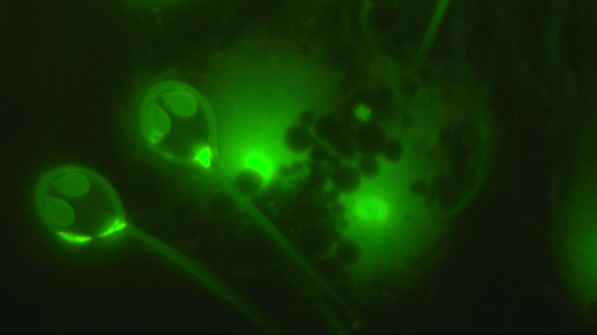 Kabus ger&ccedil;ek oldu! Et yiyen kurt&ccedil;uk insana bulaştı: ABD'de ilk kez... - 1. Resim