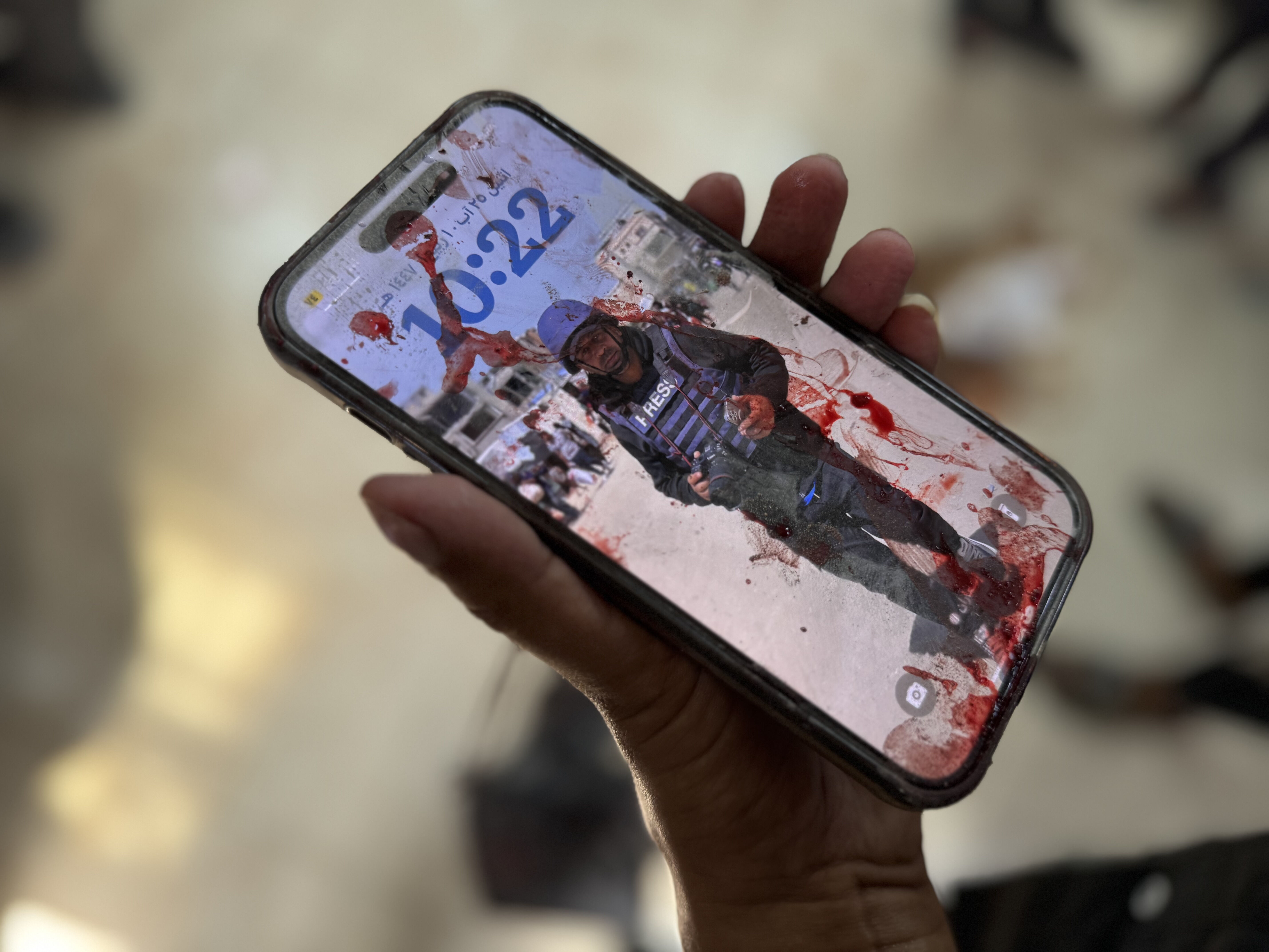 Gazze'de 5'i gazeteci çok sayıda Filistinliyi katletmişti! İsrail hastane vahşetini bu sözlerle savundu! - 1. Resim