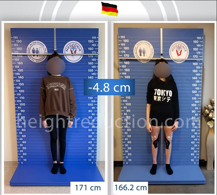 Yabancı kadınlar arasında akılalmaz trend! Boylarını kısaltmak için Türkiye'ye akın ediyorlar - 2. Resim