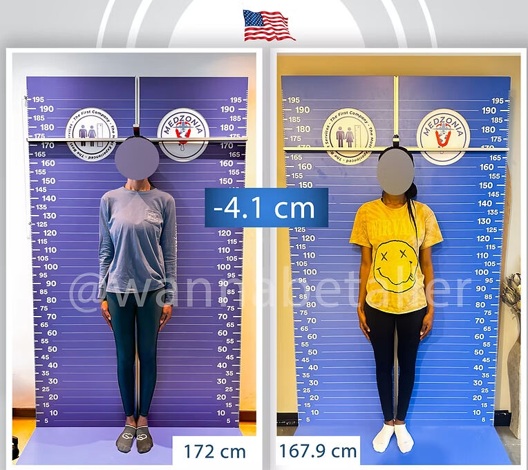 Yabancı kadınlar arasında akılalmaz trend! Boylarını kısaltmak için Türkiye'ye akın ediyorlar - 1. Resim