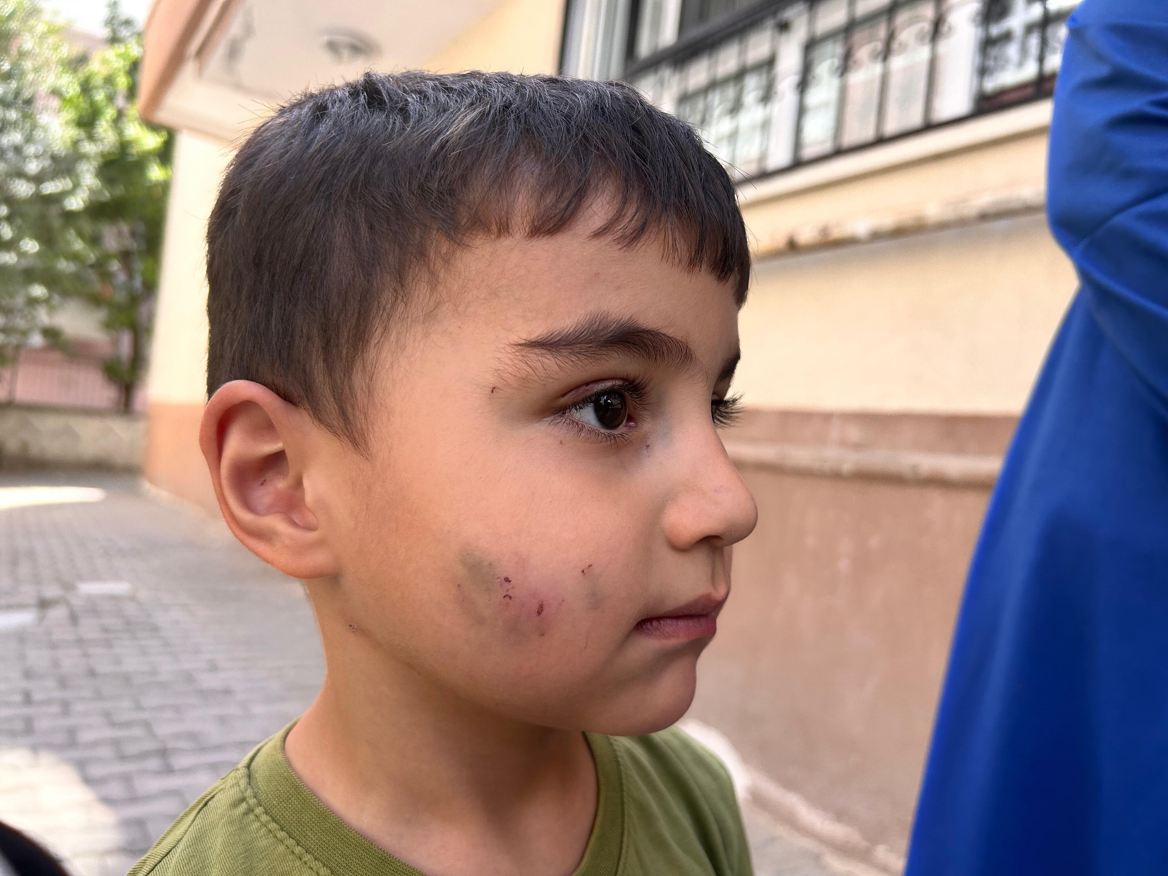 Sabah çocuklarının ağlama sesiyle uyandılar: 