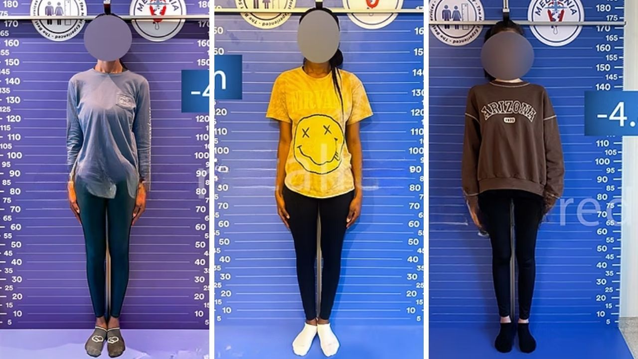Yabancı kadınlar arasında akılalmaz trend! Boylarını kısaltmak için Türkiye&#039;ye akın ediyorlar