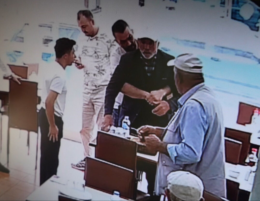 Yemek yerken canından oluyordu! 