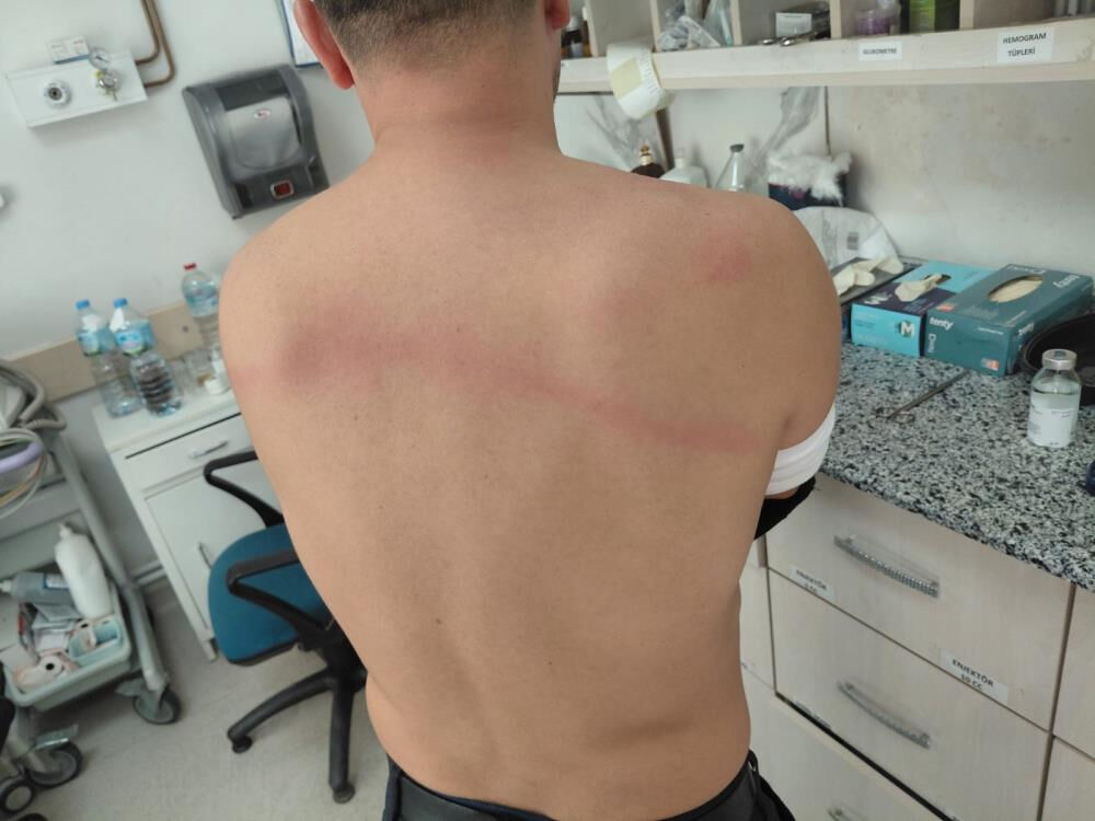 CHP'li Belediye Başkanı zabıtaları sopayla d&ouml;vd&uuml; iddiası - 3. Resim