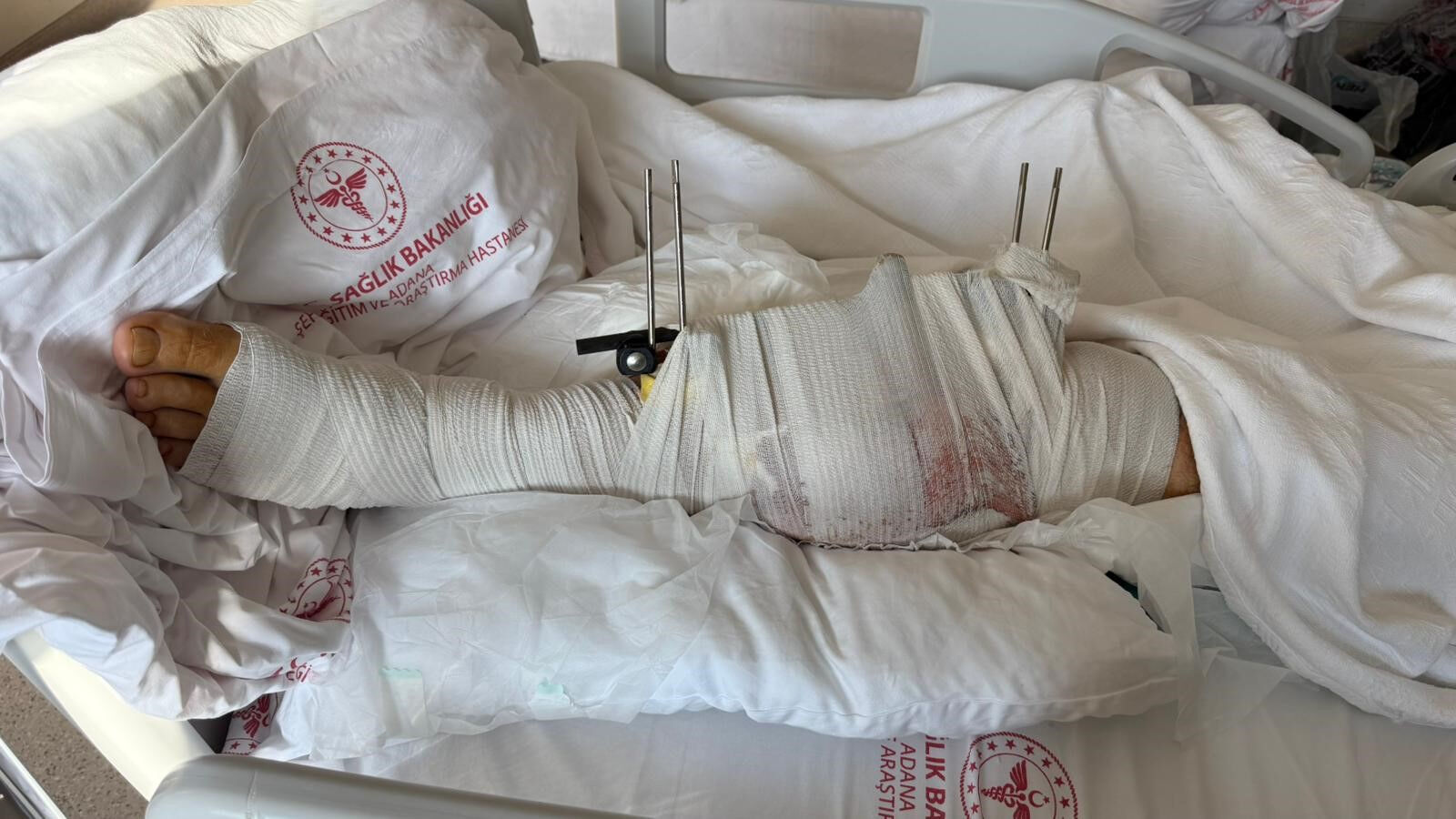 Adana’da kanlı olay: Eski damadının evleneceğini öğrenen muhtar kabusu yaşattı - 2. Resim