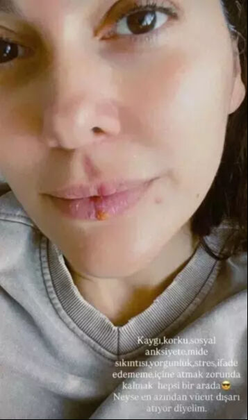 Bergüzar Korel'den korkutan paylaşım! ''Vücudum tepki gösteriyor'' diyerek duyurdu - 1. Resim