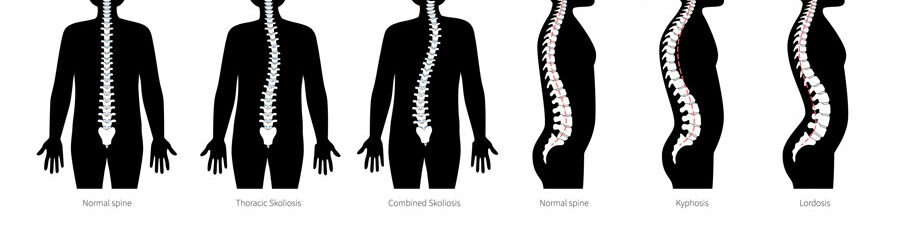 Sadece omurga değil, ayaklar da tehlikede! Uzmanlardan uyardı: Her yıl söyleniyor ama veliler dikkat etmiyor Sadece omurga değil, ayaklar da tehlikede! Uzmanlardan uyardı: Her yıl söyleniyor ama veliler dikkat etmiyor - 2. Resim