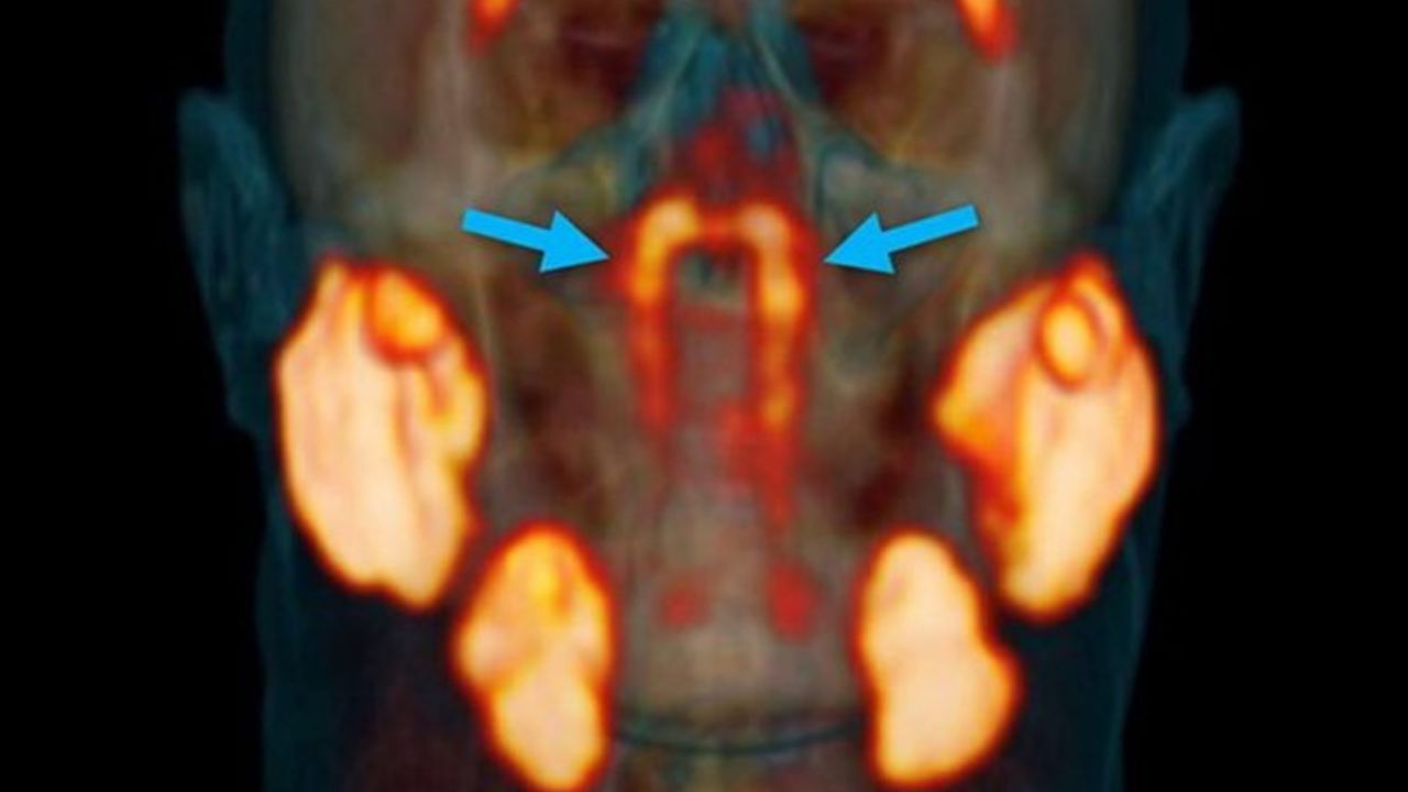 Bilim insanları insan vücudunda yeni organ buldu! Bilim insanları insan vücudunda yeni organ buldu!