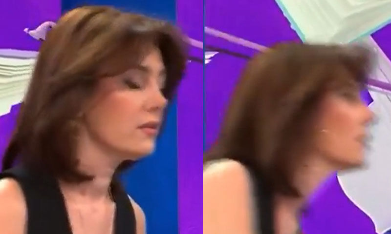 Canlı yayında bayılan Burcu Binici hastalığını açıkladı! “Doğuştan gelen rahatsızlığım nedeniyle…” - 1. Resim