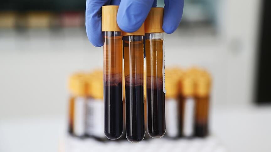 Okulda rahatsızlanıp hayatını kaybetmişti! Acı gerçek otopside ortaya çıktı - 2. Resim