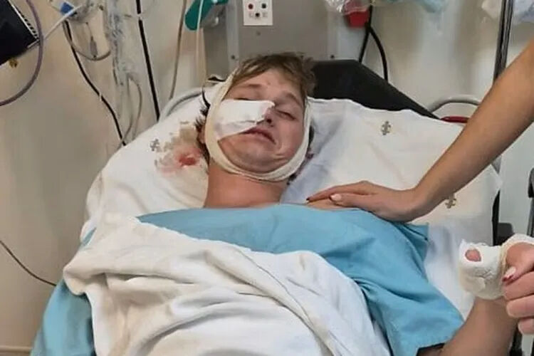 Kamp tatili faciayla sonlandı! Sırtlanlar uykusunda saldırdı - 1. Resim