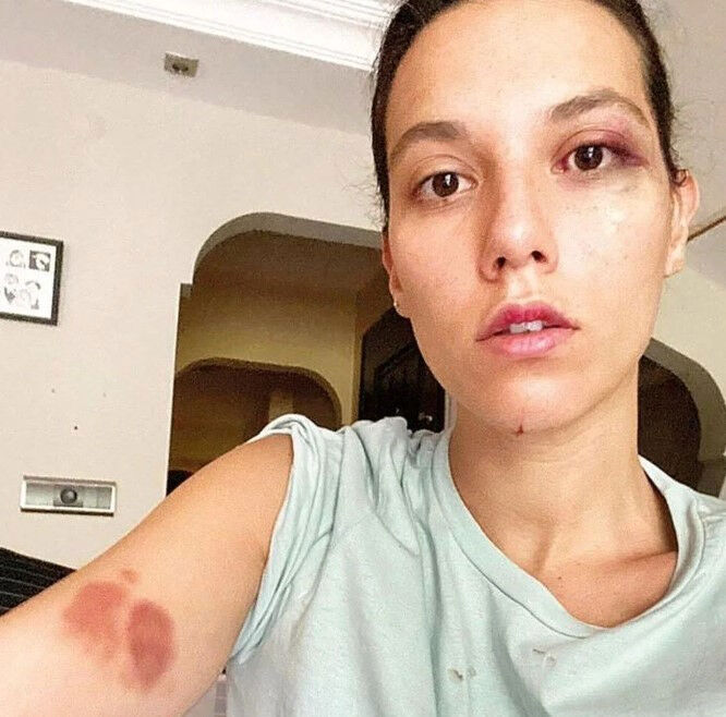 Son projesi başlamadan ayrılmıştı… Ozan Güven sosyal medyada sessizliğini bozdu - 1. Resim