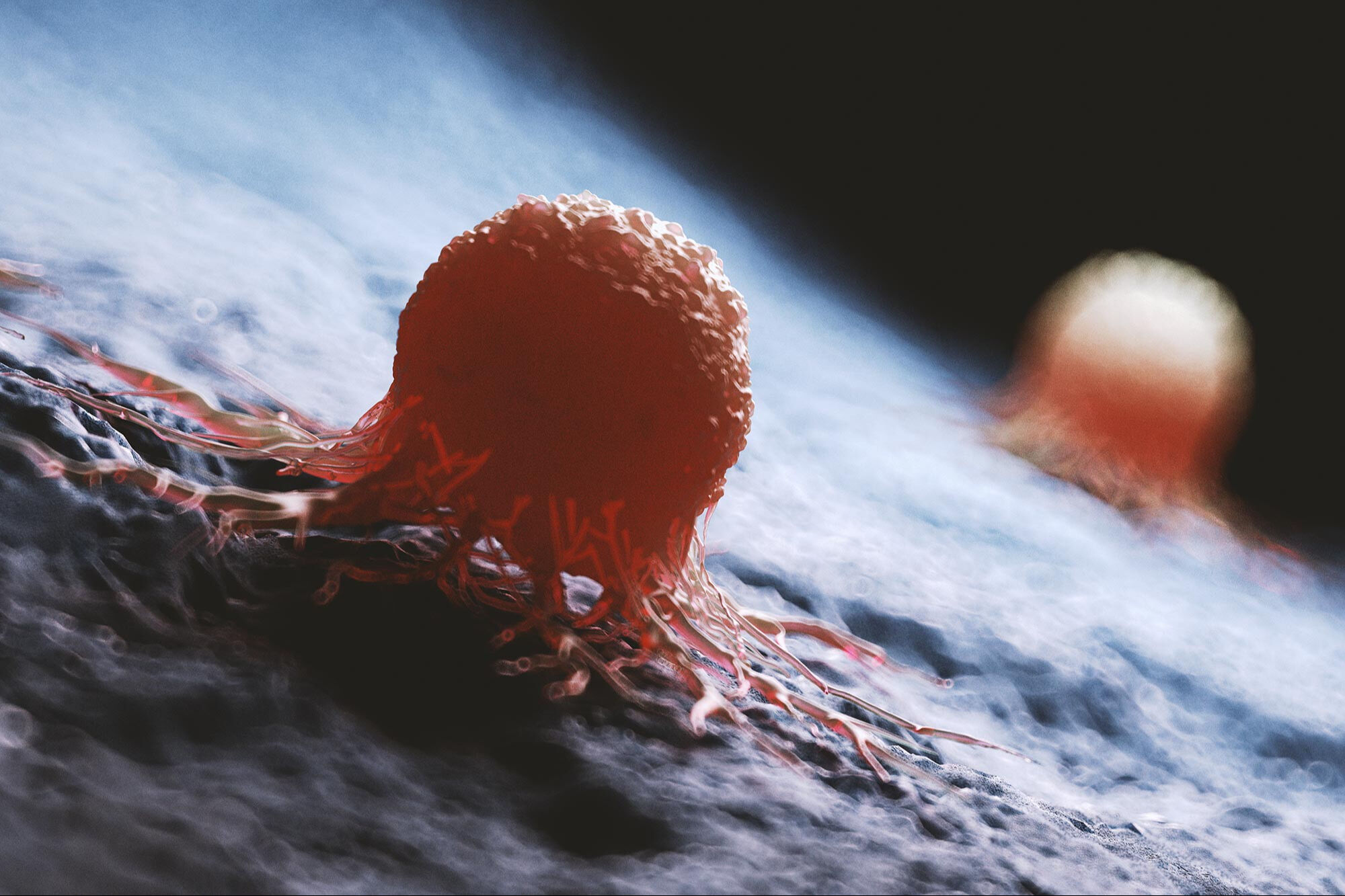 Tek bir egzersiz seansı kanser hücrelerini yavaşlatıyor! Tek bir egzersiz seansı kanser hücrelerini yavaşlatıyor! - 1. Resim