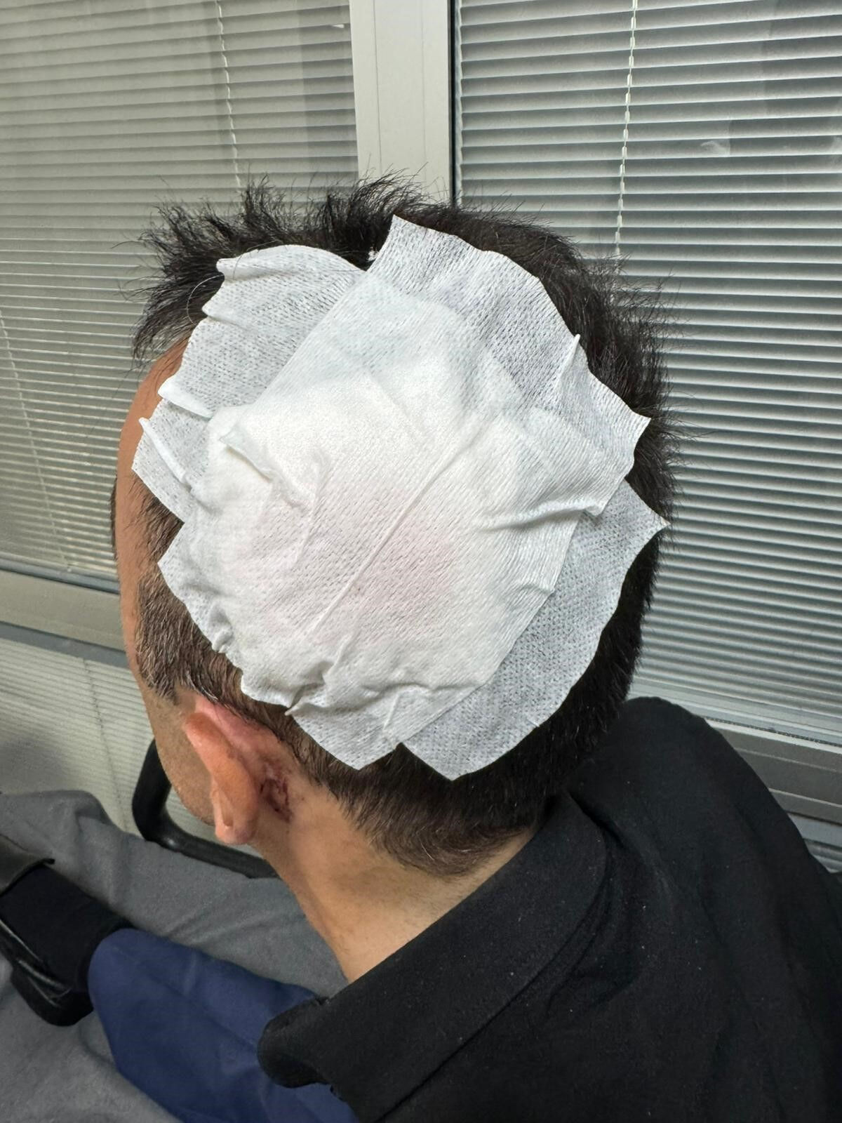 Bayburt'ta motosiklet Kazası! Engelli bireye çarpan ehliyetsiz sürücü kaçtı Bayburt'ta Motosiklet Kazası! Engelli bireye çarpan ehliyetsiz sürücü kaçtı - 2. Resim