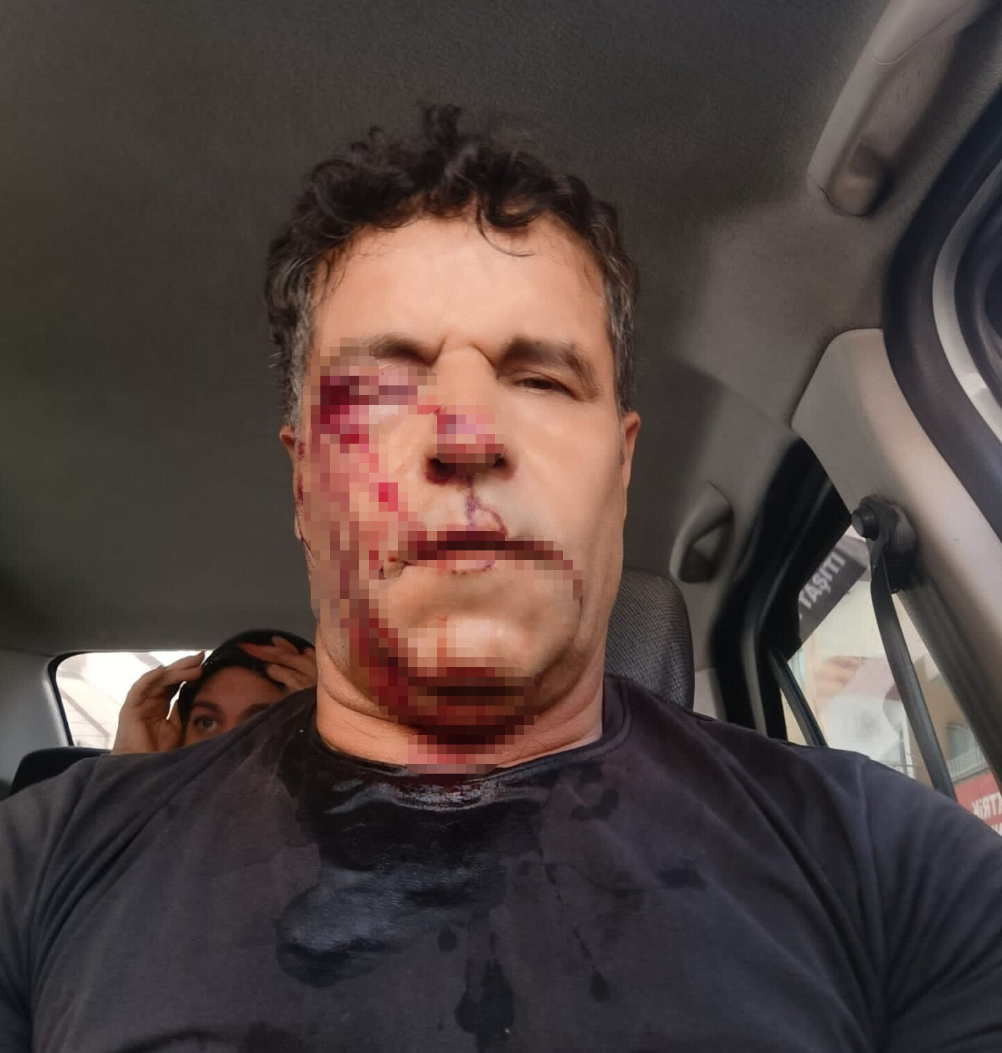 Kafasını taşla ezmek istediler! Kocasını akrabalarından böyle kurtardı Kafası taşla ezmek istediler! Kocasını akrabalarından böyle kurtardı - 1. Resim