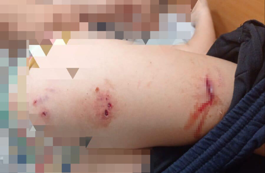 Başıboş sokak köpekleri yine saldırdı! 9 yaşındaki çocuk hastanelik oldu Başıboş sokak köpekleri yine saldırdı! 9 yaşındaki çocuk hastanelik oldu - 1. Resim