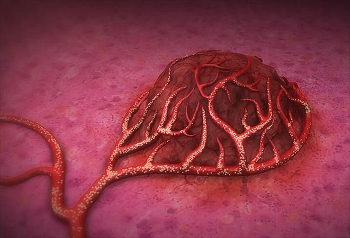 Uzmanı tavsiye etti! Düzenli egzersizlerle kanserin önüne geçilebilir - 3. Resim