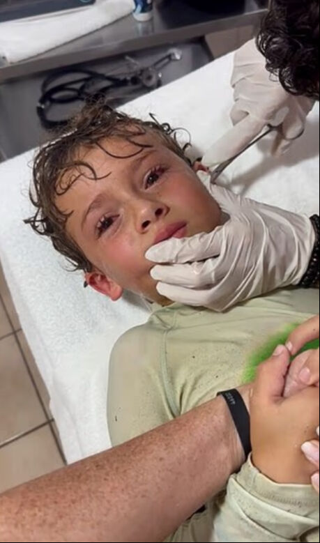 Meksika'da deniz keyfi kabusa dönüştü! Kulağından çıkan doktorları bile şaşkına çevirdi - 1. Resim