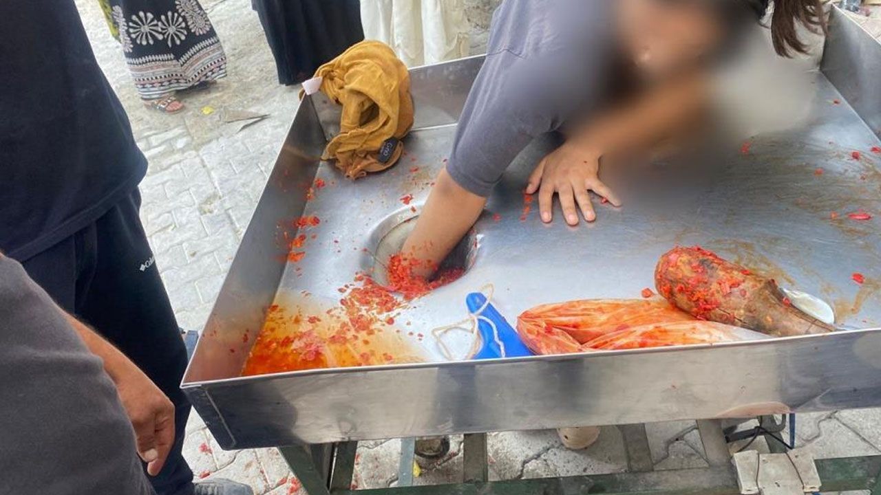 Salça yapımında korku dolu anlar: genç kızın eli makinede sıkıştı