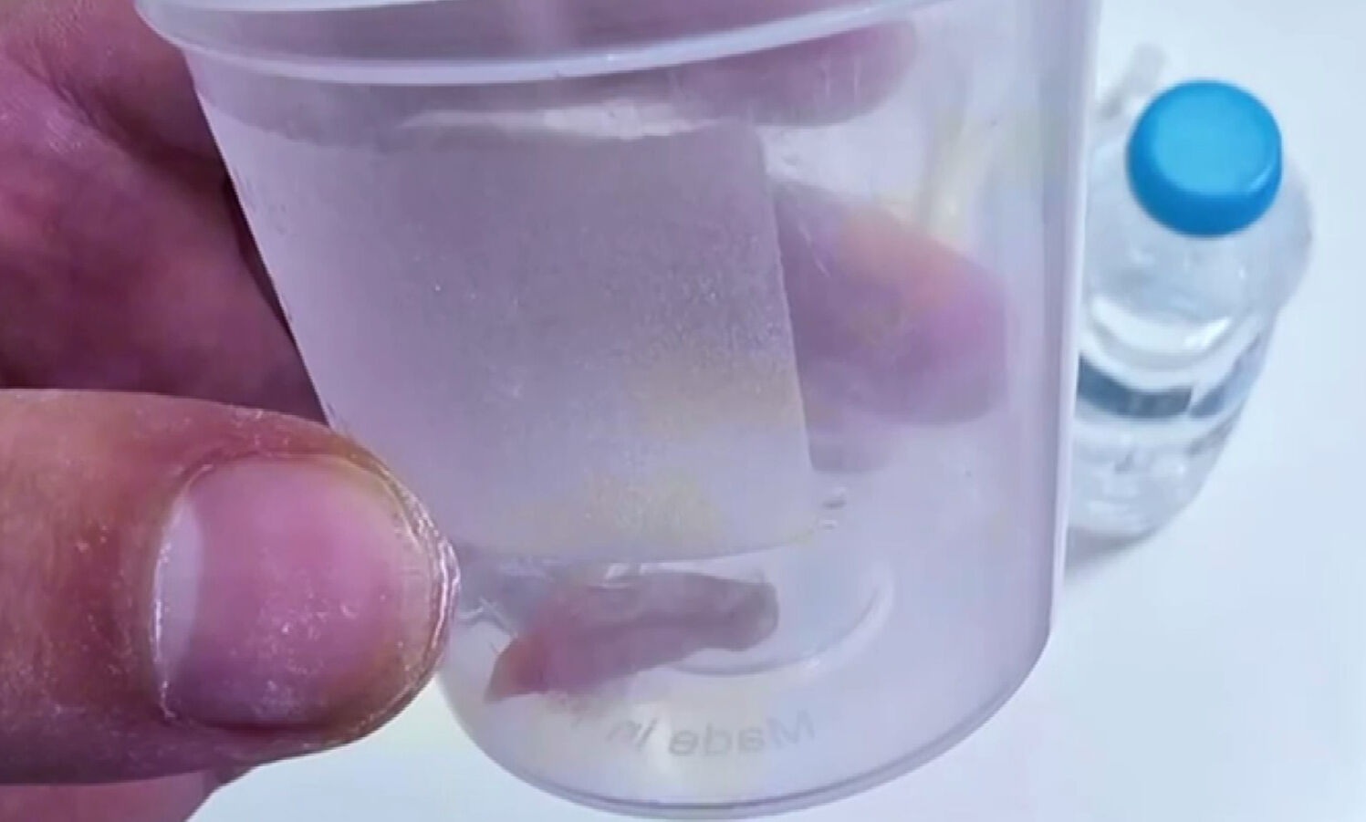 1,5 yıldır öksüren hastanın akciğerinde kabak çekirdeği çıktı! Hemen operasyona alındı 1,5 yıldır öksüren hastanın akciğerinde kabak çekirdeği çıktı! Hemen operasyona alındı - 2. Resim