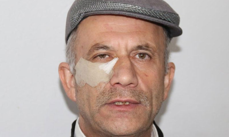 Cami yolunda dehşet: Komşusu darp etti! “Elmacık kemiğim çökmüş” - 2. Resim