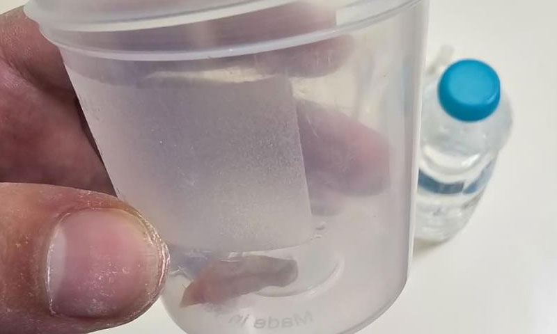 Öksürükten uyuyamıyordu… 'Astımsın' hatta 'kansersin' dediler, sebebi çok başka çıktı - 3. Resim