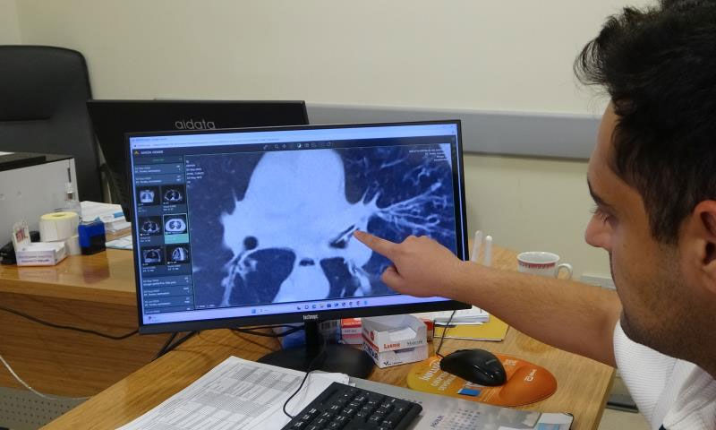 Öksürükten uyuyamıyordu… 'Astımsın' hatta 'kansersin' dediler, sebebi çok başka çıktı - 1. Resim