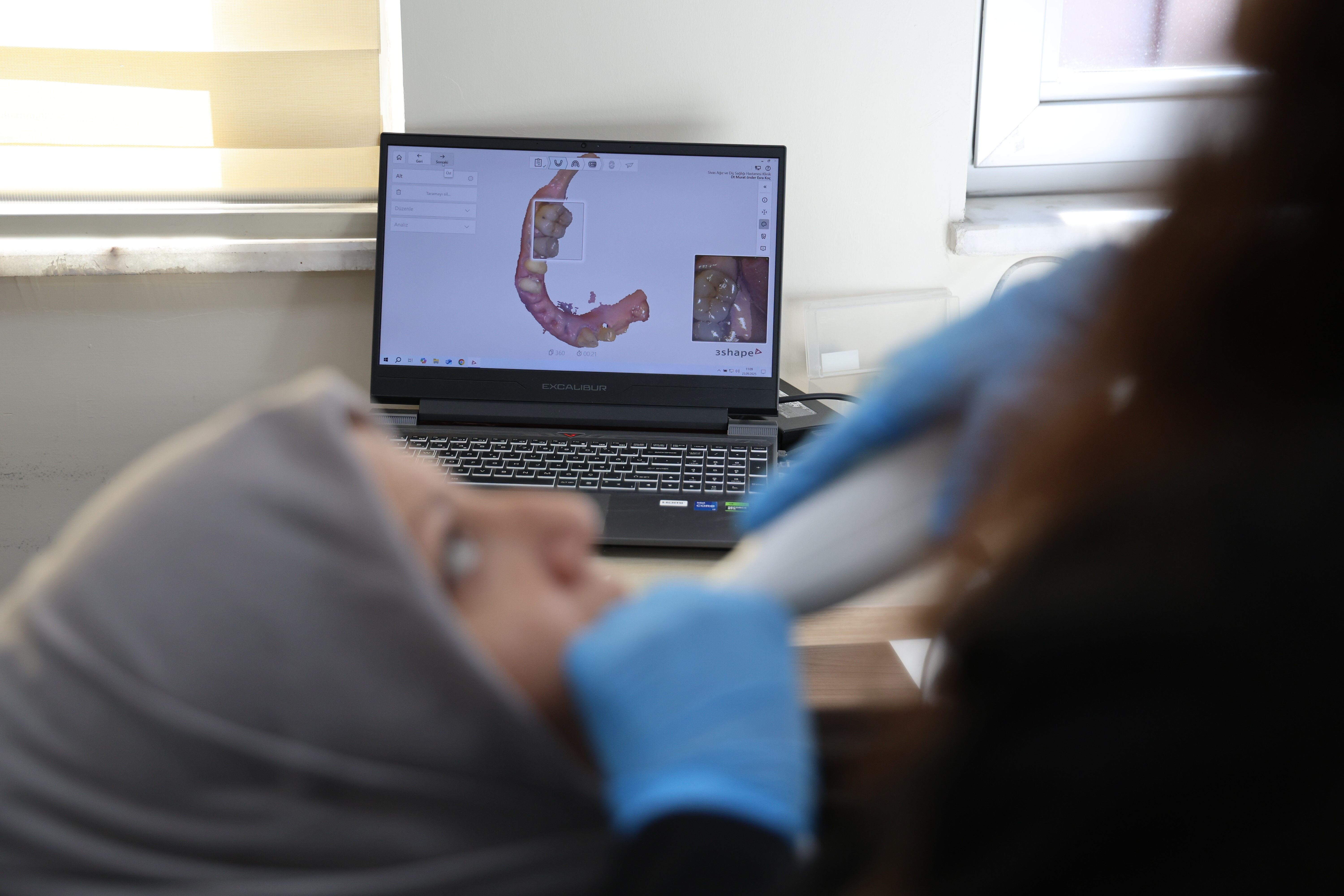 Özelde 8 bin TL'ye yapılan zirkonyum kaplama, devlet hastanesinde 188 TL'ye yapılmaya başlandı - 4. Resim