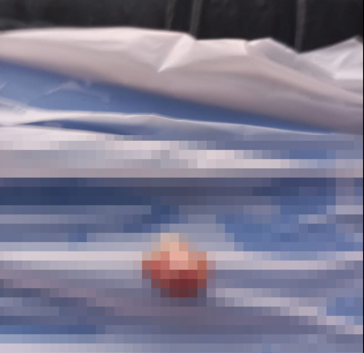 Sınıf kapısına eli sıkışan çocuğun parmağı koptu! "Öğretmen derse devam etti" iddiası ortalığı karıştırdı - 2. Resim