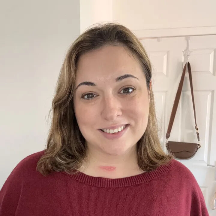 İngiltere'de 36 yaşındaki kadın, esnerken boyun omurlarını kırdı! Yaşama şansı y&uuml;zde 50'ydi - 4. Resim