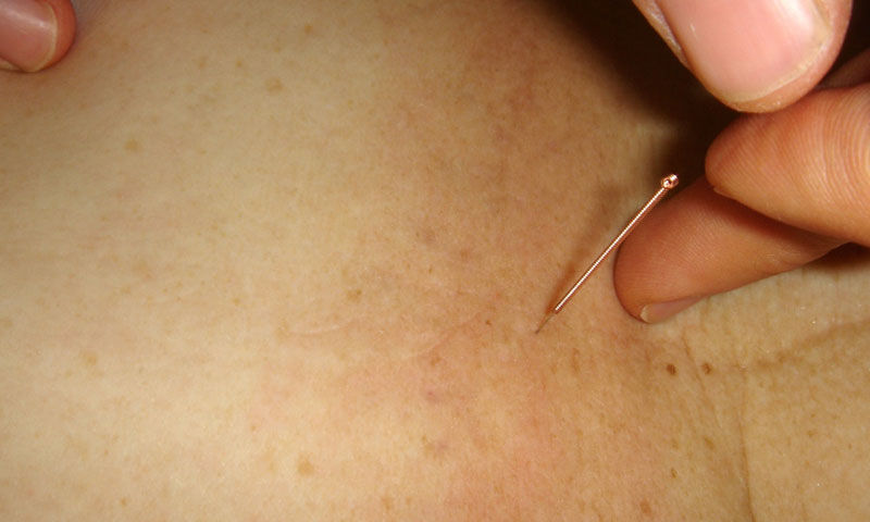 Diz ağrısına ameliyatsız çözüm buldu! Merdivenlerden inemezken yeniden koşmaya başladı - 3. Resim