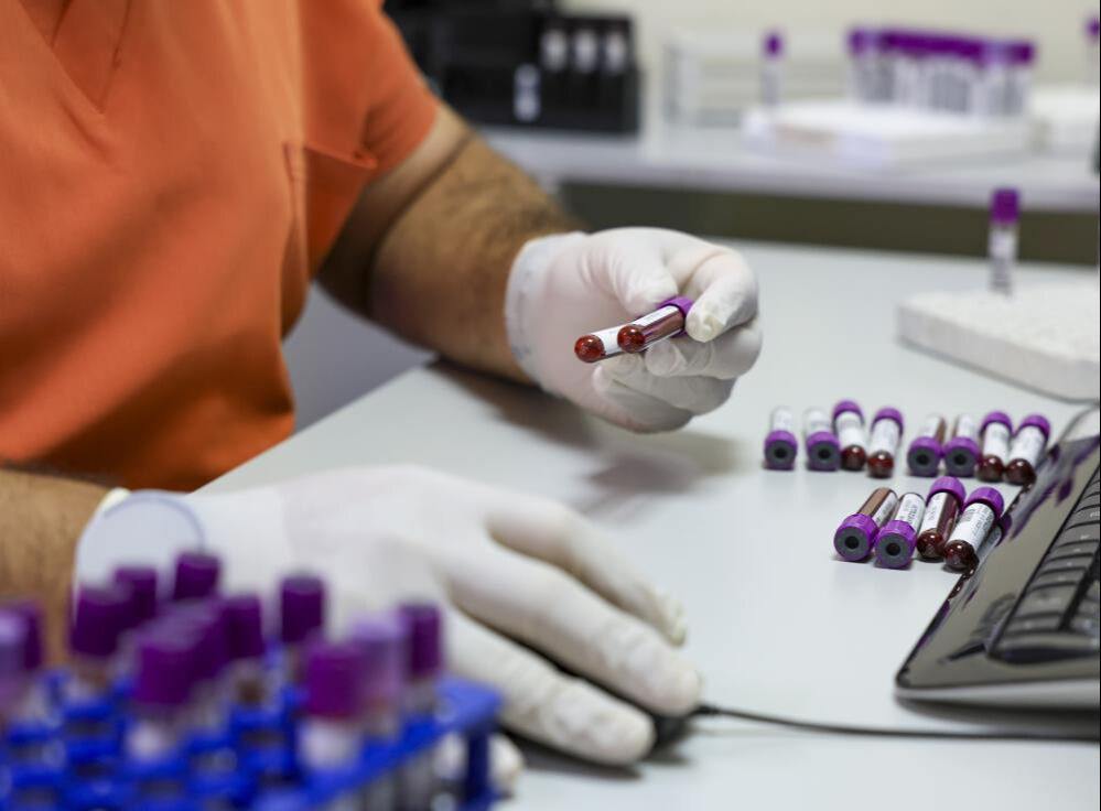 6 milyonda bir görülüyor, Türkiye'de ilk! 'Altın kan' anne-bebeği kurtardı - 2. Resim