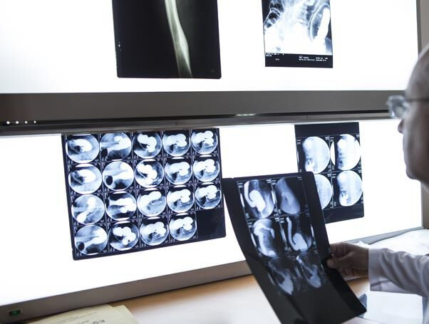 Mikroplastik tehlikesi b&uuml;y&uuml;yor! Kemiklerden beyin dokularına kadar ulaşıyor - 1. Resim