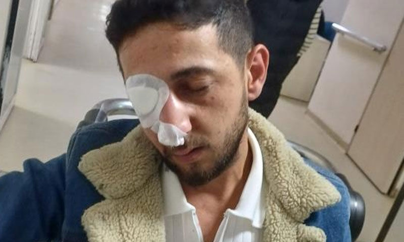 Düğünde havai fişek faciası: Gözünde patladı! 