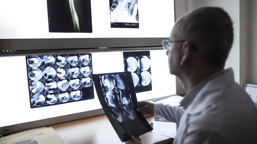 Diz Osteoartriti hastalarına yeni tedavi yöntemi! Düşük radyasyonla ağrılar azalacak - 2. Resim