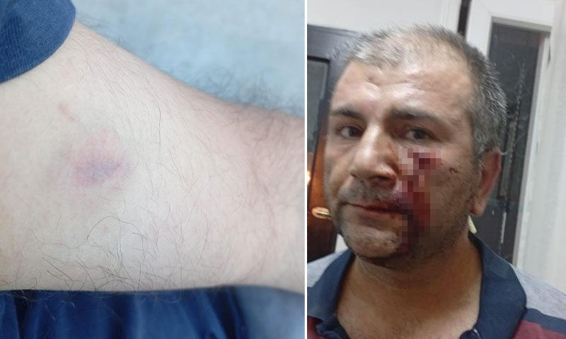 “Kenara çekilir misiniz” diye uyardı, camide 10 kişinin saldırısına uğradı - 2. Resim