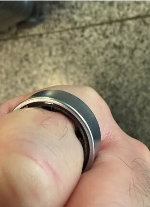 Ünlü YouTuber akıllı yüzüğü yüzünden hastanelik oldu! O anları sosyal medya hesabından paylaştı - 2. Resim